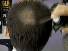 Средство от лысины